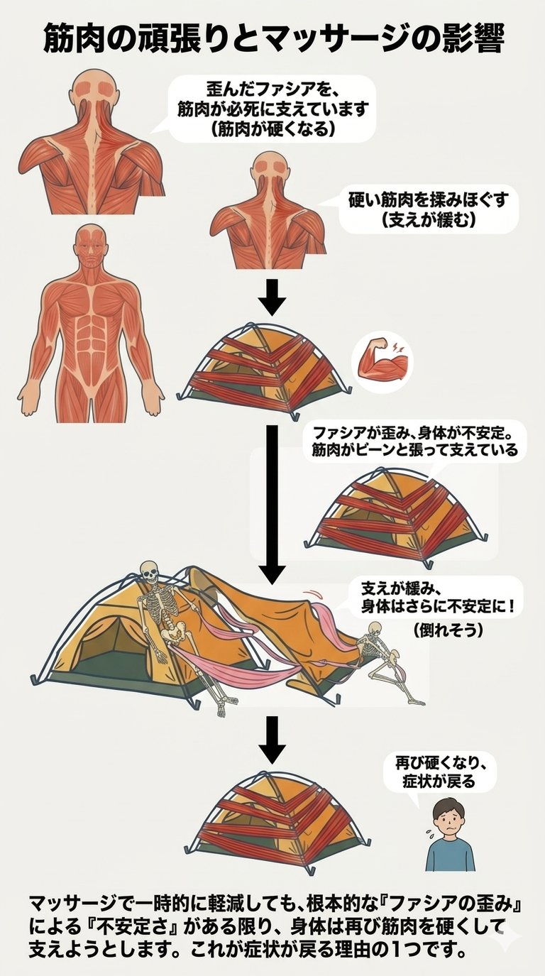 このようにテント(ファシア)がズレると 骨組み(骨格)はバランスを崩し テントは倒れてしまいますが ヒトはそうもいきません。 ここで働くのが”筋肉”です。 そんな頑張って支えてくれている筋肉を 揉みほぐすとどうなるでしょうか? 支えが緩み、さらに不安定になり、 また筋肉は硬くなります。 これがマッサージで一時的に軽減しても また症状が戻る理由の一つです。