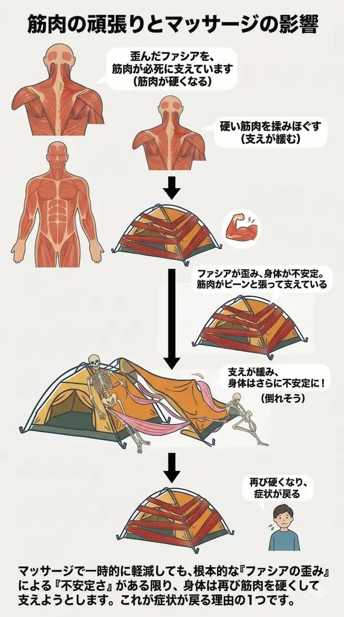 このようにテント(ファシア)がズレると 骨組み(骨格)はバランスを崩し テントは倒れてしまいますが ヒトはそうもいきません。 ここで働くのが”筋肉”です。 そんな頑張って支えてくれている筋肉を 揉みほぐすとどうなるでしょうか? 支えが緩み、さらに不安定になり、 また筋肉は硬くなります。 これがマッサージで一時的に軽減しても また症状が戻る理由の一つです。