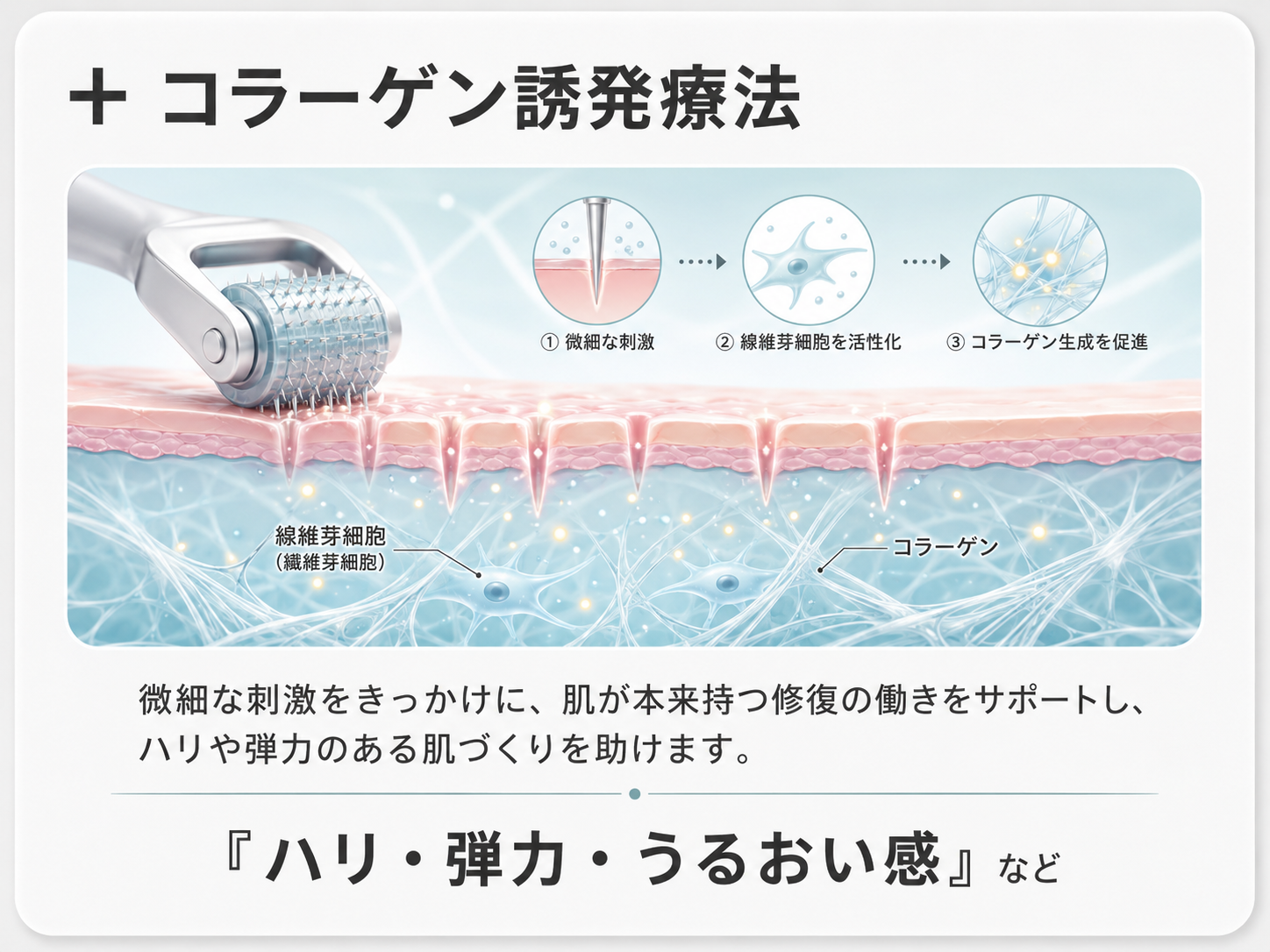 コラーゲン誘発療法