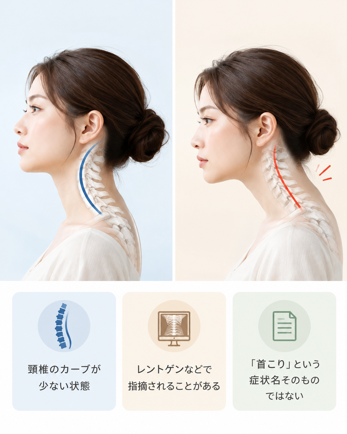 自然な頸椎のカーブとストレートネックと呼ばれる状態の違いを説明した図